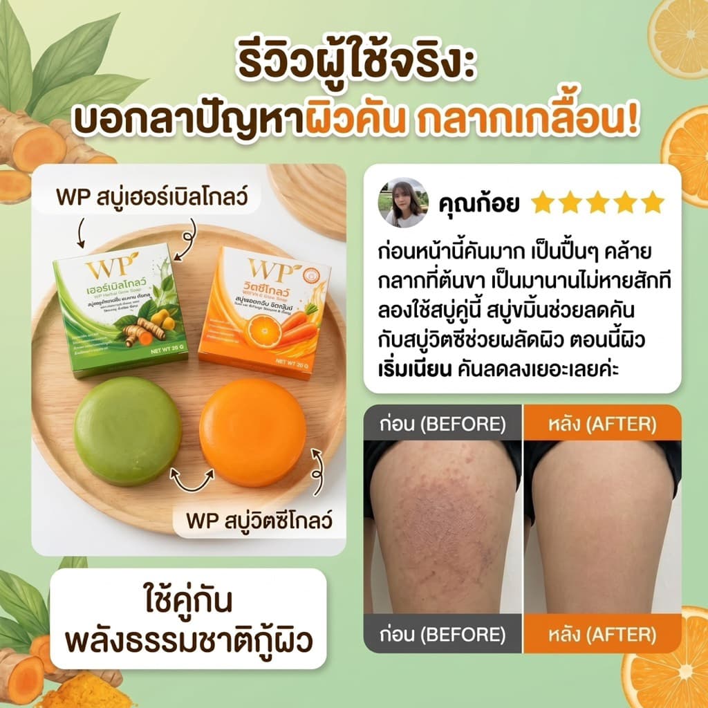 สบู่WPเฮอร์เบิลโกลว์ ใช้ได้ทั้งผิวหน้าและผิวกาย สมุนไพรออแกนิก 100% หยุดคัน หยุดเกา รูปที่ 5