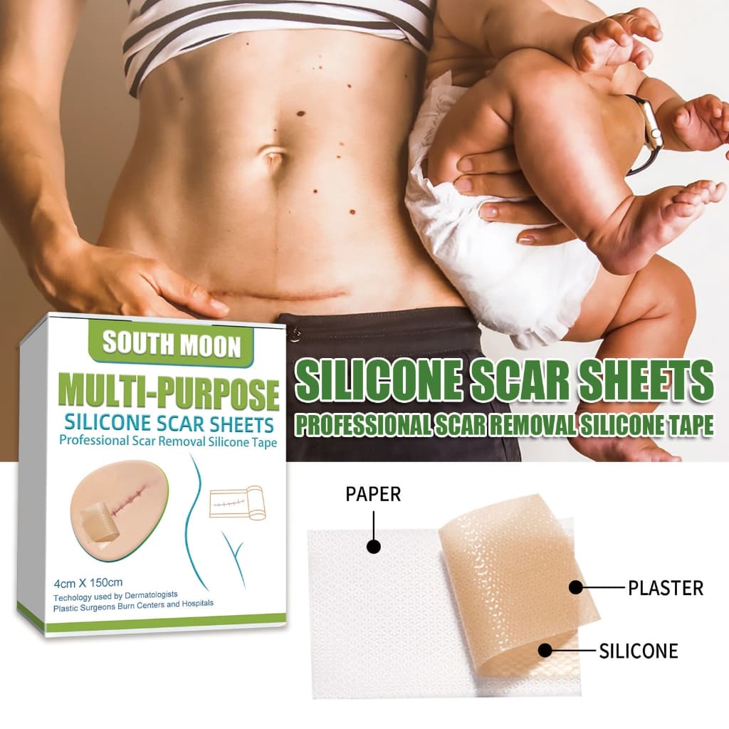 South Moon silicone scar sheet รักษารอยแผลเป็น แผ่นแปะแผลเป็น กําจัดรอยแผลเป็นจากแผลเป็น เผยผิวเนียนสวย รูปที่ 5