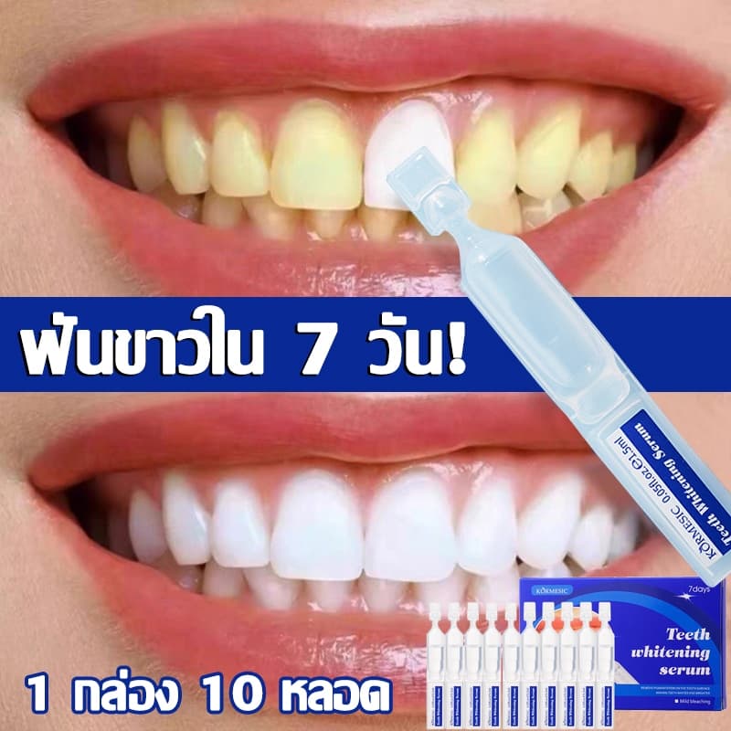ฟอกฟันขาว ฟันขาว น้ำยาฟอกฟันขาว ที่ฟอกฟันขาว ยาฟอกฟันขาว น้ำยาขัดฟันขาวTeeth Whitening Pen ปากกาฟอกฟันขาว เจลฟอกฟันขาว รูปที่ 1
