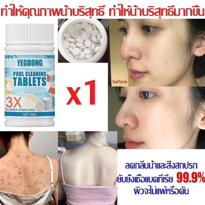 คลอรีนเม็ด ยับยั้งแบคทีเรีย99% คลอรีนก้อน ฆ่าเชื้อ กำจัดกลิ่นในน้ำ เม็ดฟู่ คลอรีนใส่น้ำ ผิวจะดีขึ้น คอรีน คลอรีนสระน้ำ รูปที่ 7