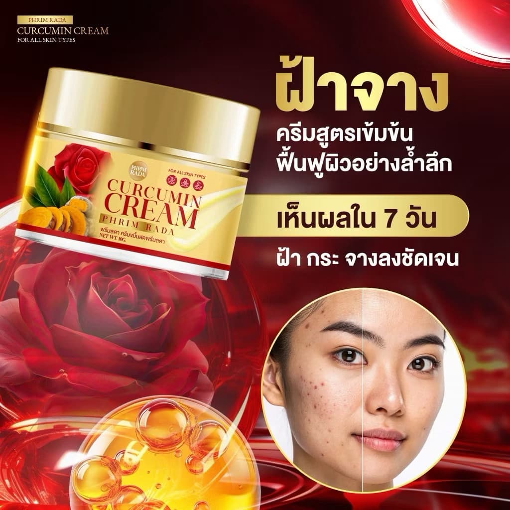 ครีมขมิ้นกุหลาบ พรีมลดา หน้าขาวใส ฝ้า กระจาง รูปที่ 5