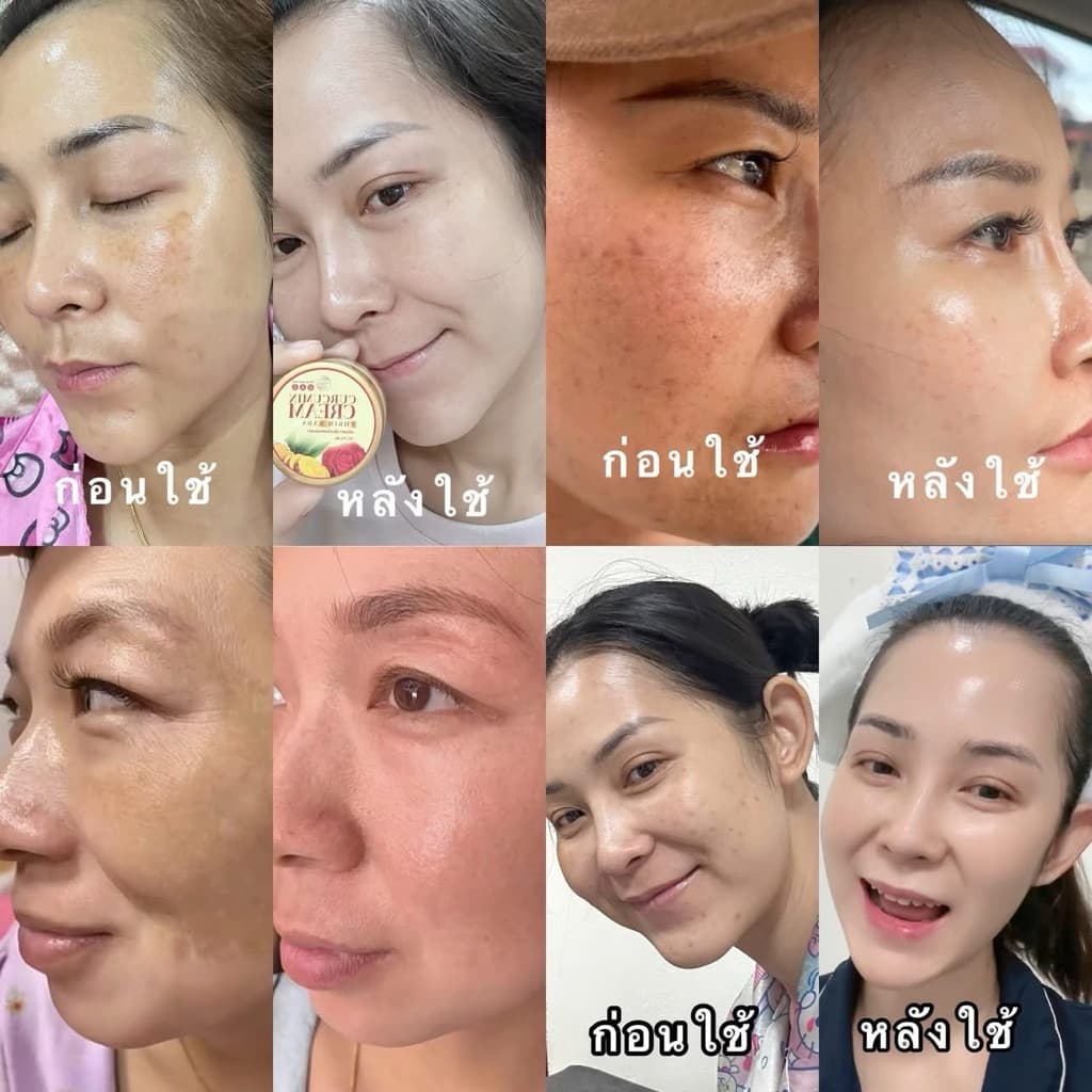 ครีมขมิ้นกุหลาบ พรีมลดา หน้าขาวใส ฝ้า กระจาง รูปที่ 8