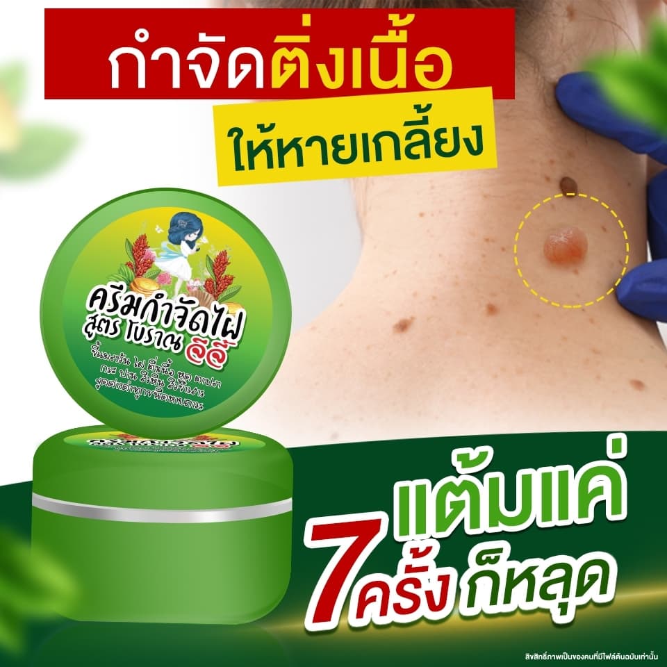 ครีมไฝจีจี้ ขี้แมลงวัน ติ่งเนื้อ หูด ตาปลา แก้ปัญหา กระ สิวหิน ครีมแต้มไฝจีจี้ไฝ หูด จี้ไฝ แต้มไฝ หูดติ่งเนื้อ รูปที่ 1