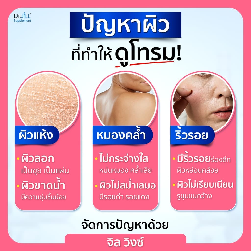 3 กล่อง จิลวิงซ์ อาหารเสริมดูแลผิว Dr.JiLL Jil Wink 1กล่อง 20แคปซูล ลดริ้วรอย ผิวขาวใส นุ่ม รูปที่ 4