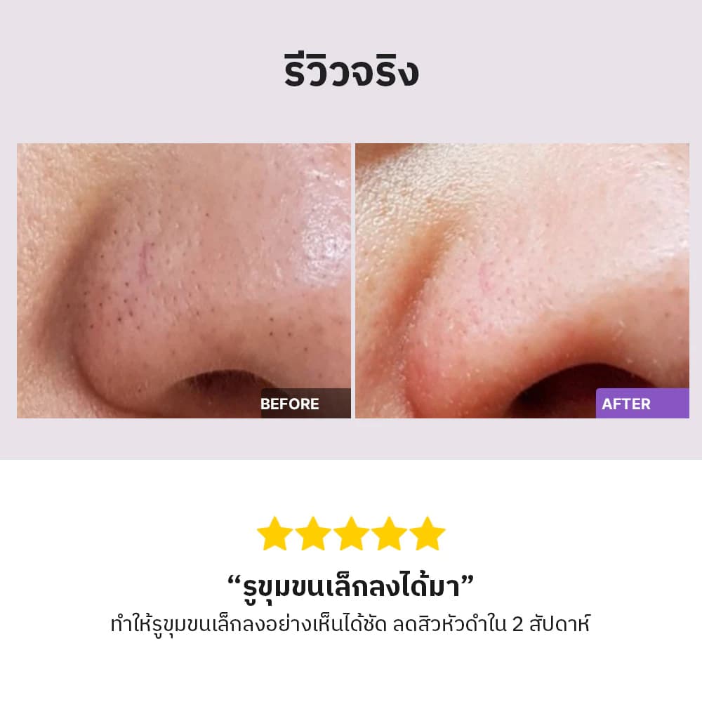 cosrx BHA 4% Blackhead Power Liquid 100ml บีเอชเอ แบล็คเฮด เพาเวอร์ ลิควิด รูปที่ 7
