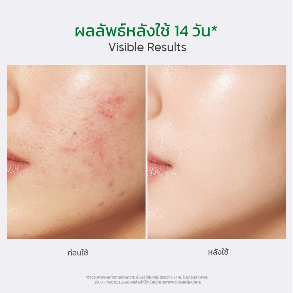 Facerinna Salicylic Acid Acne Moisturizer ครีมลดสิว BHA ละลายสิวอุดตัน ควบคุมความมัน บรรเทาสิวอักเสบ รอยแดง เจลลดรอยสิว รูปที่ 7