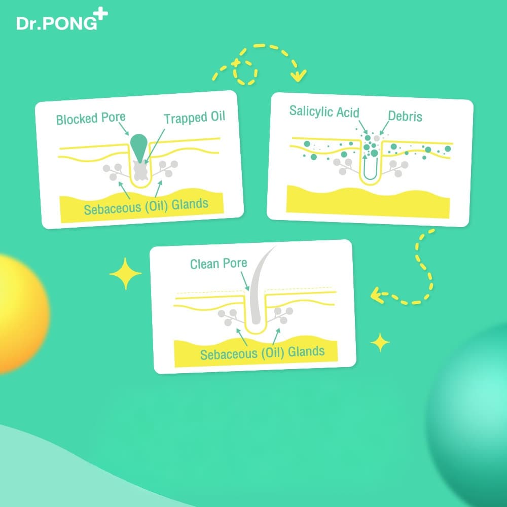 Dr.PONG B3 Acne Clear Body Spray สเปรย์ฉีดที่หลัง และลำตัว Niacinamide - BHA - ZincPCA รูปที่ 5