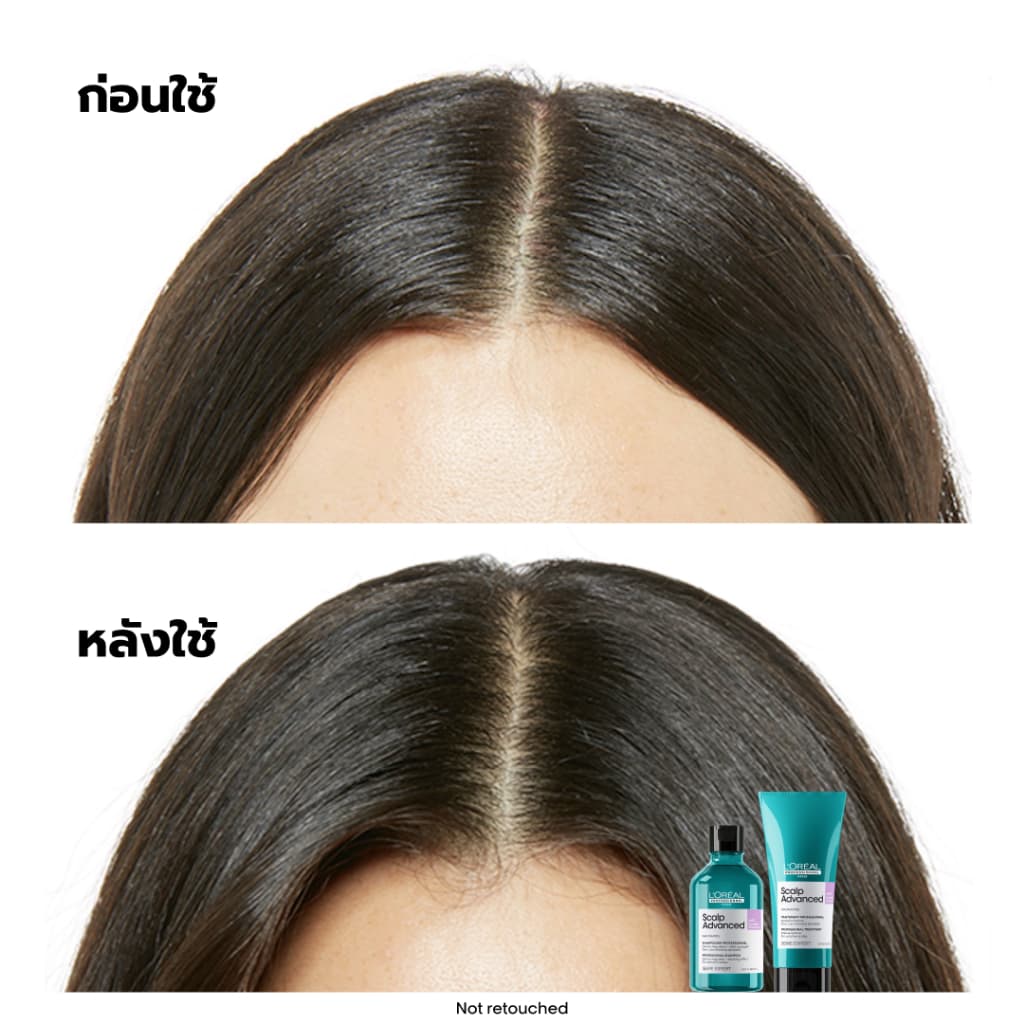 L'Oreal Professionnel Scalp Advanced Anti-discomfort Shampoo แชมพูสูตรอ่อนโยนพิเศษดูแลหนังศีรษะระคายเคืองง่าย 300ml รูปที่ 5