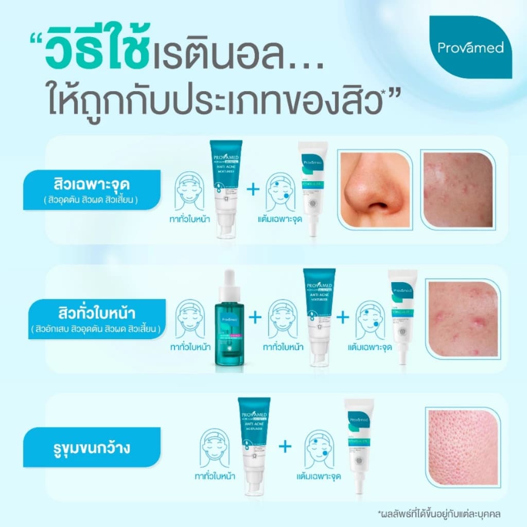 โปรวาเมด แอคเน่ เรตินอล-เอ เจล ทาสิว สิวอุดตัน สิวเสี้ยน รูปที่ 5