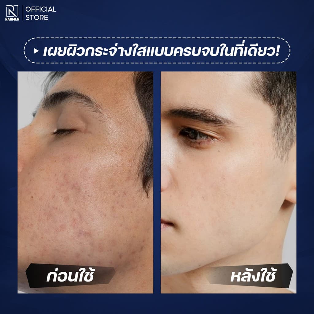 RAUMEN Combo ผู้ชาย: โฟมล้างหน้า + BB Cream 4IN1 + ครีมอาบน้ำน้ำหอม คุมมัน ลดสิว รูปที่ 3