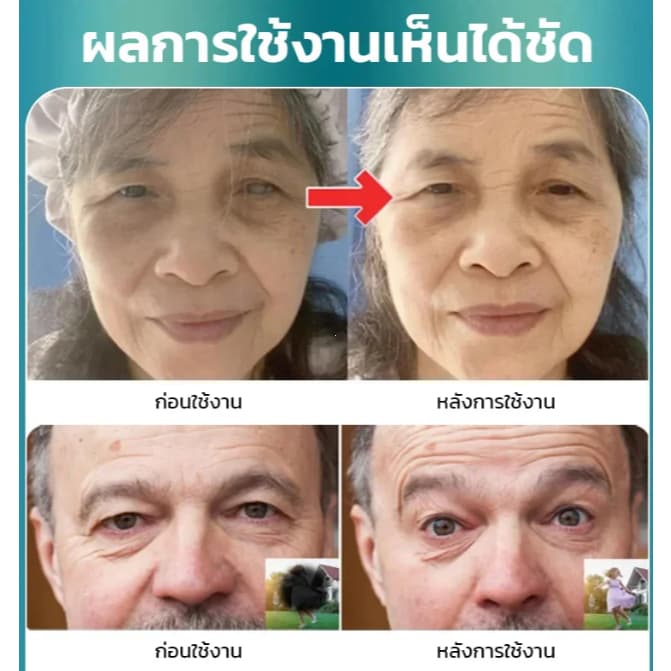 DR.RERDIA Cooling Eye Gel เซรั่มบำรุงรอบดวงตาระดับพรีเมียม บรรเทาอาการเมื่อยล้าของดวงตา ทำให้ดวงตาสดใส ม รูปที่ 3