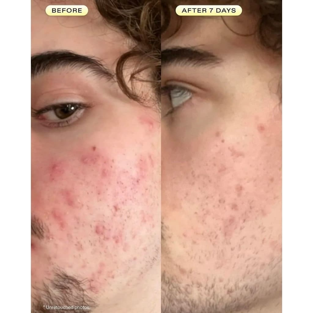 Krave beauty oil la la 45ml รูปที่ 2