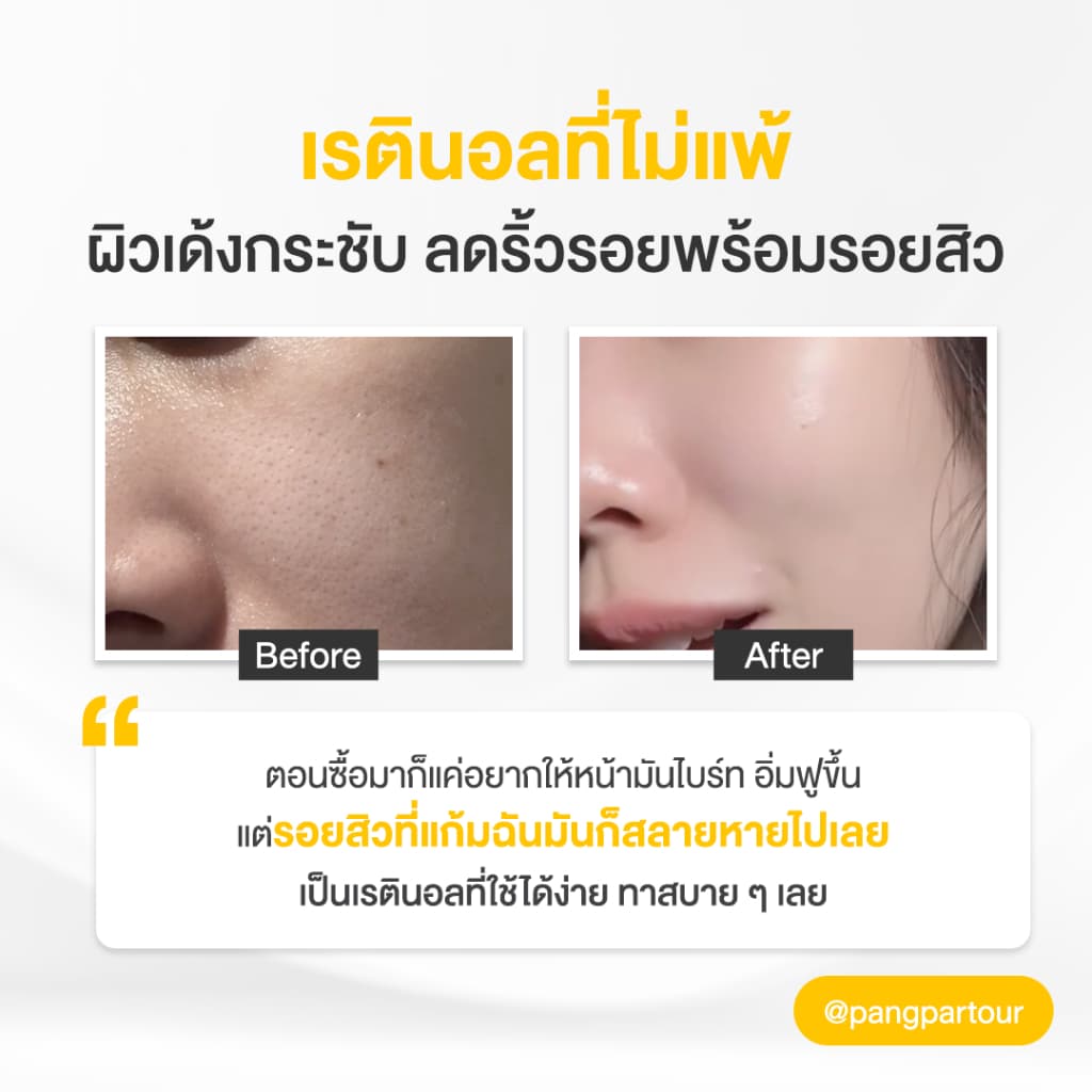 เรตินอล ที่ไม่แพ้ อ่อนโยน สูตร ผิวกระจก 4in1 Natural Retinol Moisturizer สูตร Skin Brightening 45 ml. รูปที่ 7