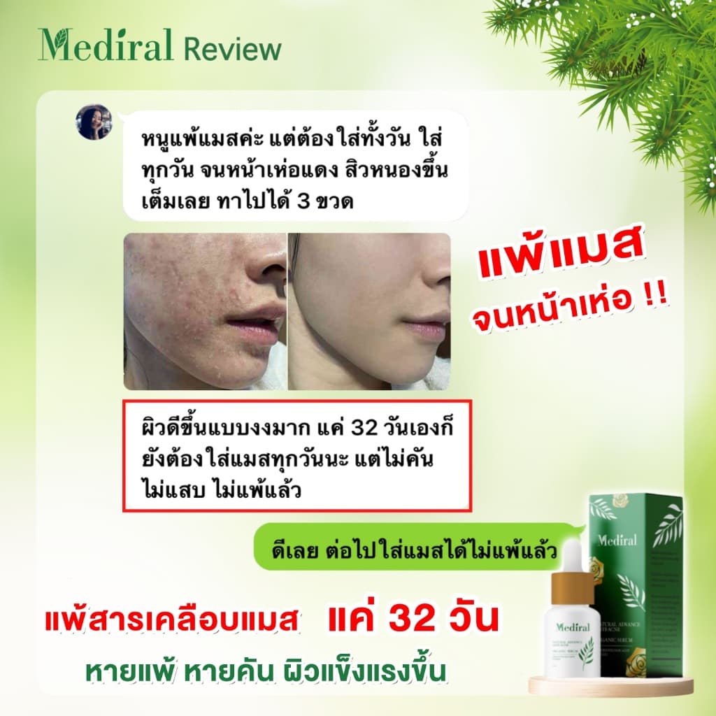 เมดิรอล เซรั่มลดสิวMediral ตัดวงจรสิวซ้ำซาก ฆ่าเชื้อสิวใน7วันดีขึ้น ผิวแข็งแรง ออร์แกนิก รูปที่ 9