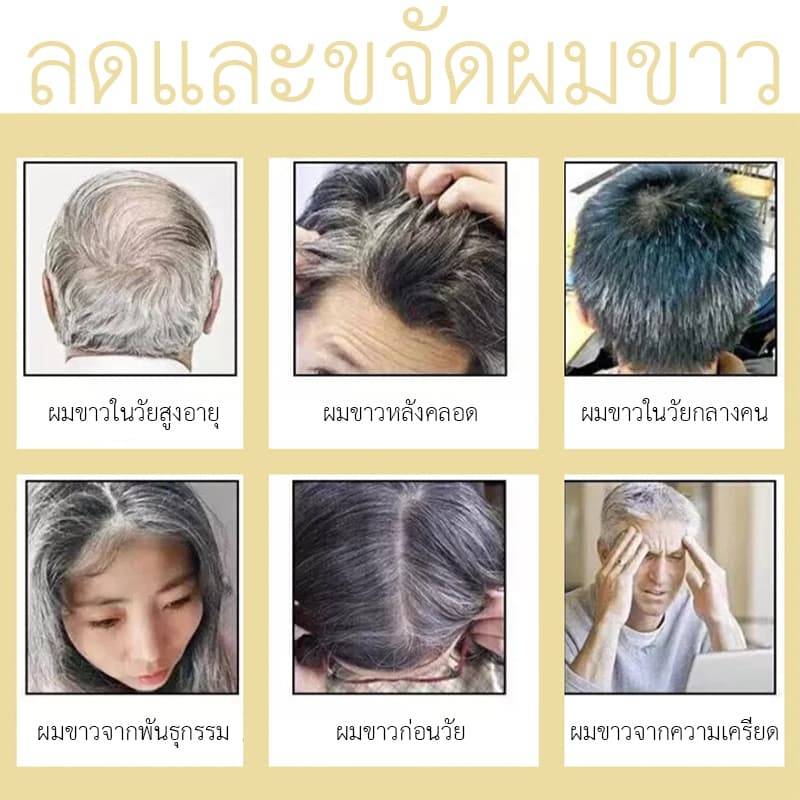 แชมพูโสมสกัดจากพืชธรรมชาติ safemild ช่วยบำรุงเส้นผมอย่างอ่อนโยนและปรับปรุงผมหงอกและผมร่วง รูปที่ 2