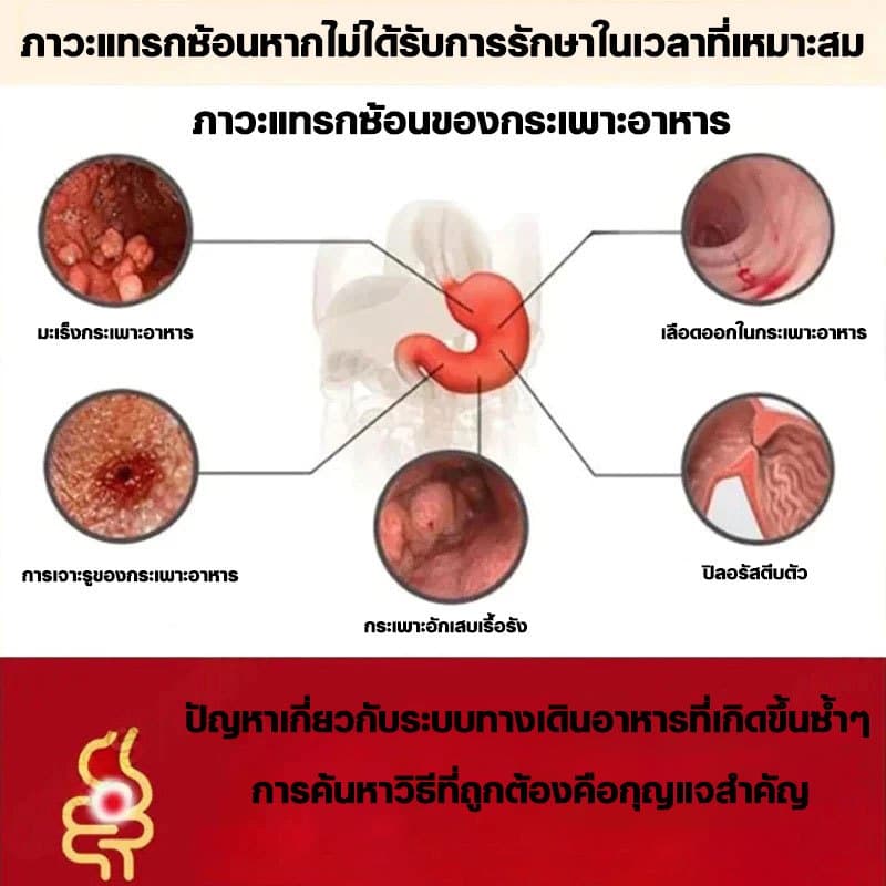 Tummiva×Kreain Nature เจลบำรุงระบบทางเดินอาหาร แก้ปวดท้อง ลดแก๊สในท้อง หยุดอาการเสียพุง รูปที่ 4