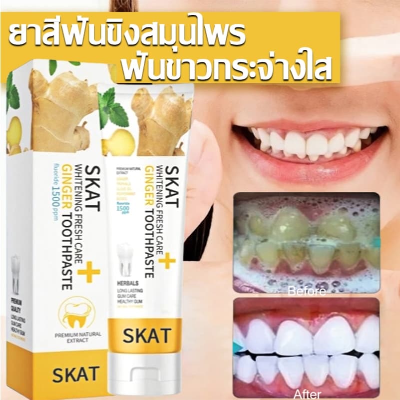 ยาสีฟันขิง ยาสีฟันสมุนไพรขิงขิง Skat ขนาด 50 กรัม ลดกลิ่นปาก ฟันขาว ฟันแข็งแรง ยาสีฟัน ยาสีฟันสูตรฟันขาว รูปที่ 2