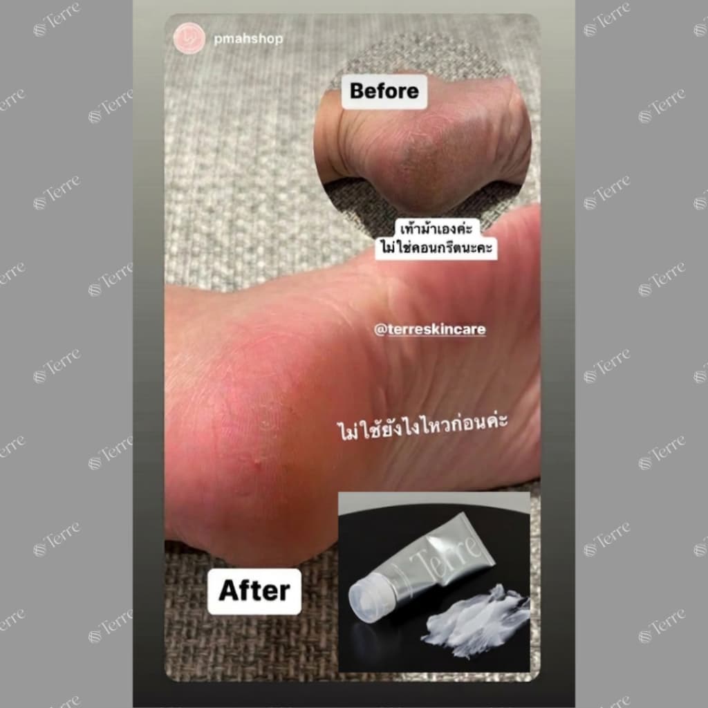 Terre Ultra Repair Cream เทอร์เร่อัลตรารีแพร์ครีม สูตรเข้มข้น สำหรับเท้า มือ ศอก เข่า 120 มล. รูปที่ 6