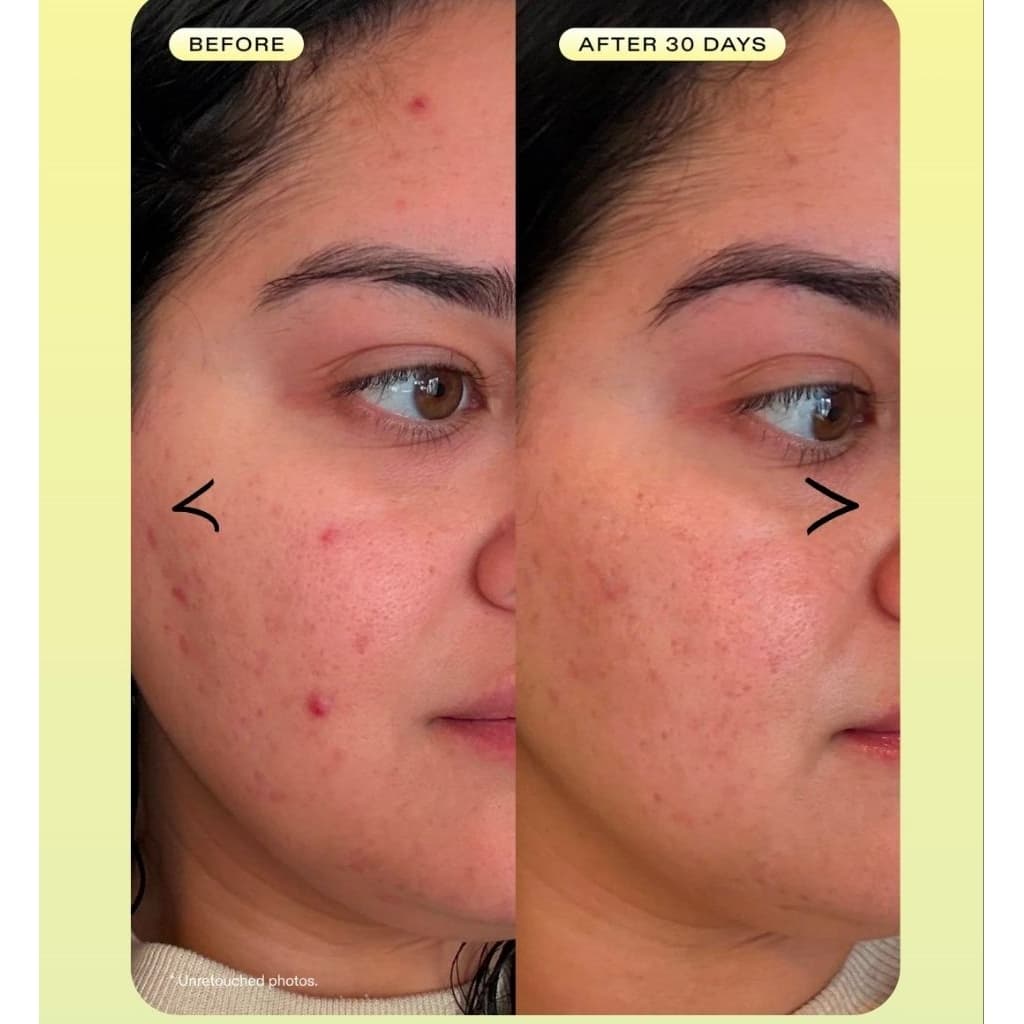 Krave beauty oil la la 45ml รูปที่ 3
