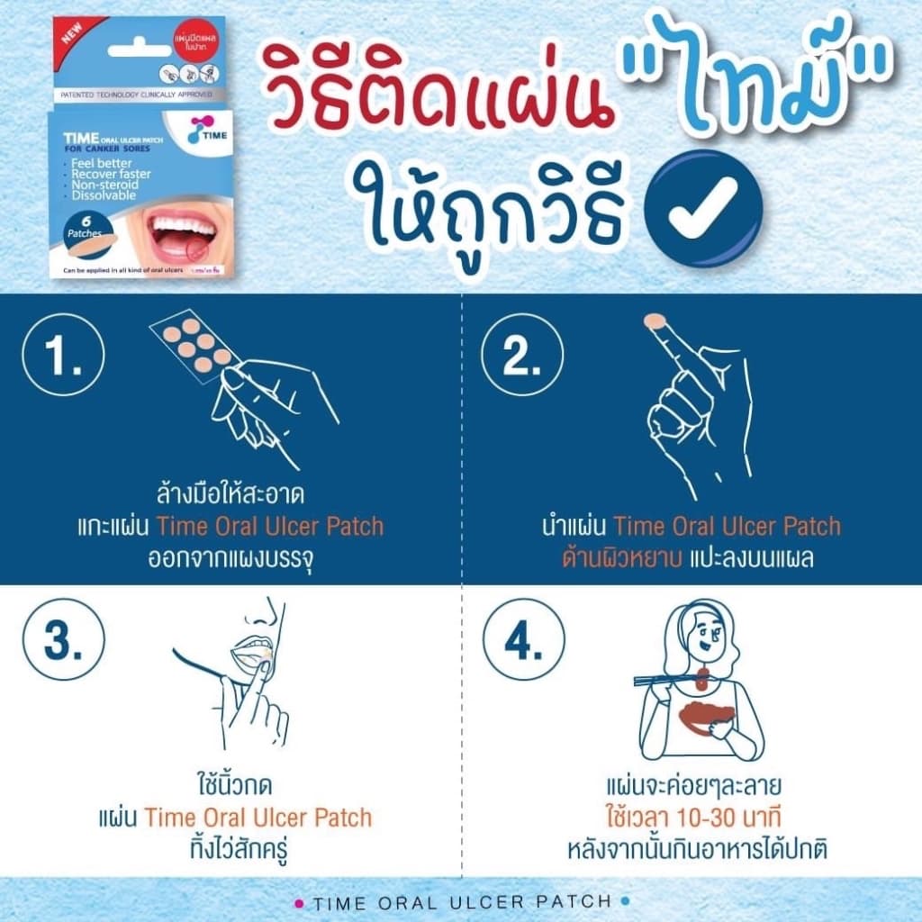 TIME Oral Ulcer Patch แผ่นปิดแผลในปาก แผ่นปิดแผลร้อนใน แผ่นแปะร้อนใน แผลร้อนใน รูปที่ 3