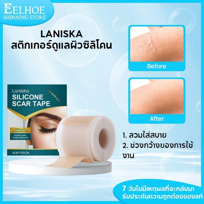 Laniska แผ่นแปะ ซิลิโคน ลดรอยแผลเป็น แผ่นแปะแผลเป็น แผ่นซิลิโคนแปะแผลเป็น ซิลิโคนแปะแผลเป็นแผ่นแปะแผลเป็นคีลอยด์ 4*150CM