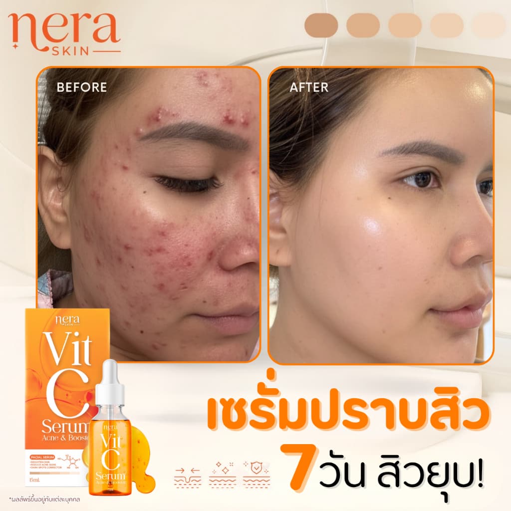 Nera Vit C เซรั่มปราบสิว รูปที่ 4