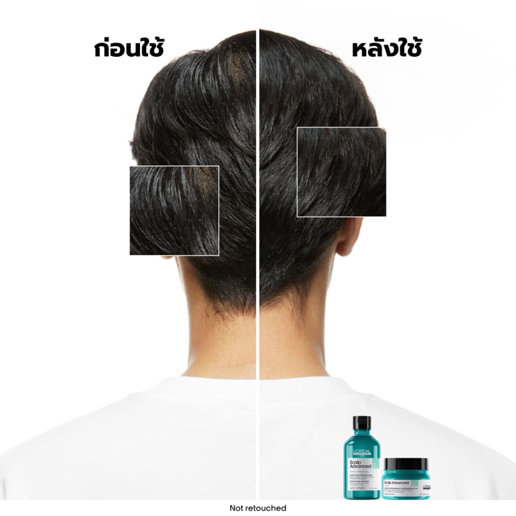 L'Oreal Professionnel Scalp Advanced Anti-oiliness Masque สครับหนังศีรษะเนื้อเคลย์ ดีท็อกซ์ความมันและสิ่งสกปรก 250ml รูปที่ 5