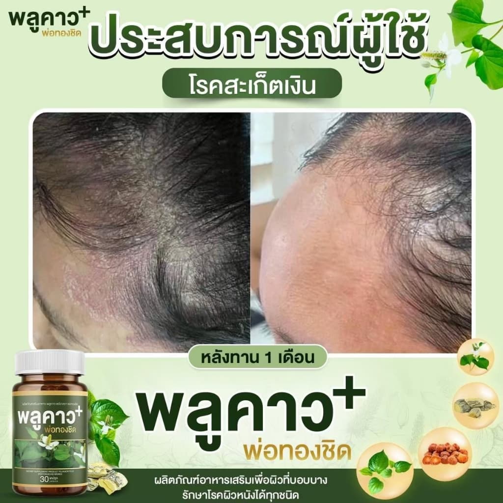 โปรดี!! 2.2 Plukaow Plus พลูคาว พลัส พ่อทองชิด ตัวดัง เซตเฮง คุ้มจริง ผลิตภัณฑ์เสริมอาหาร รูปที่ 4