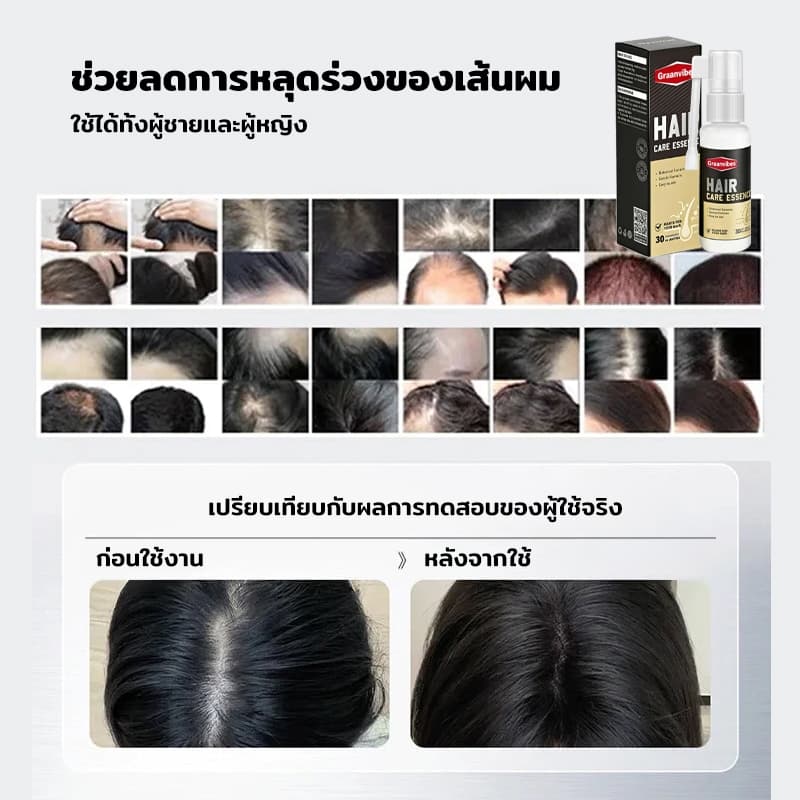 เซรั่มแก้ผมหงอก เซรั่มผมดำ เปลี่ยนผมขาวเป็นผมดกดำอย่างเป็นธรรมชาติ บำรุงรากผม สูตรเข้มข้น รูปที่ 7