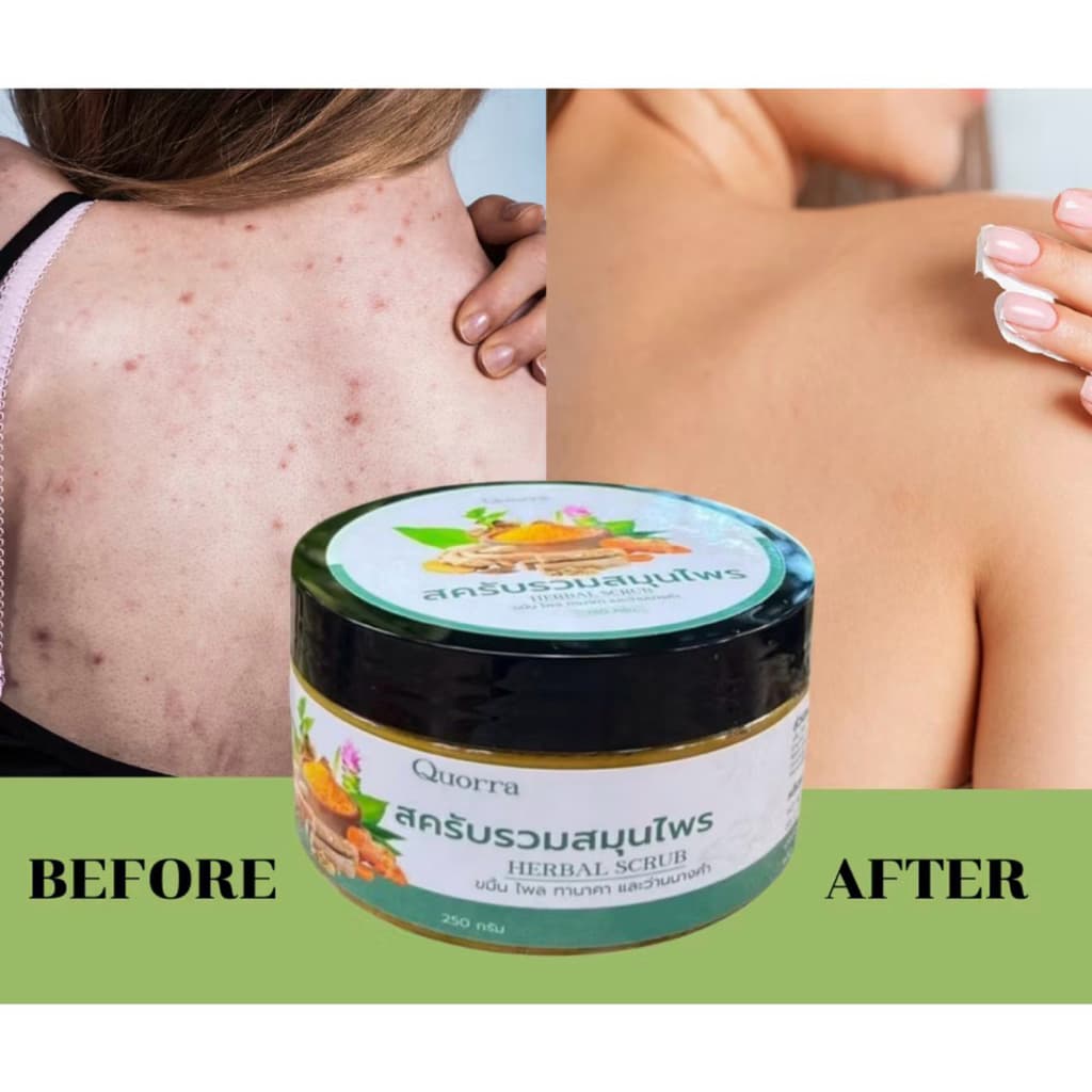 สครับสมุนไพรแท้สูตรเข้มข้น | ควอร่า Quorra Original Thai Herbal Body Scrub รูปที่ 3