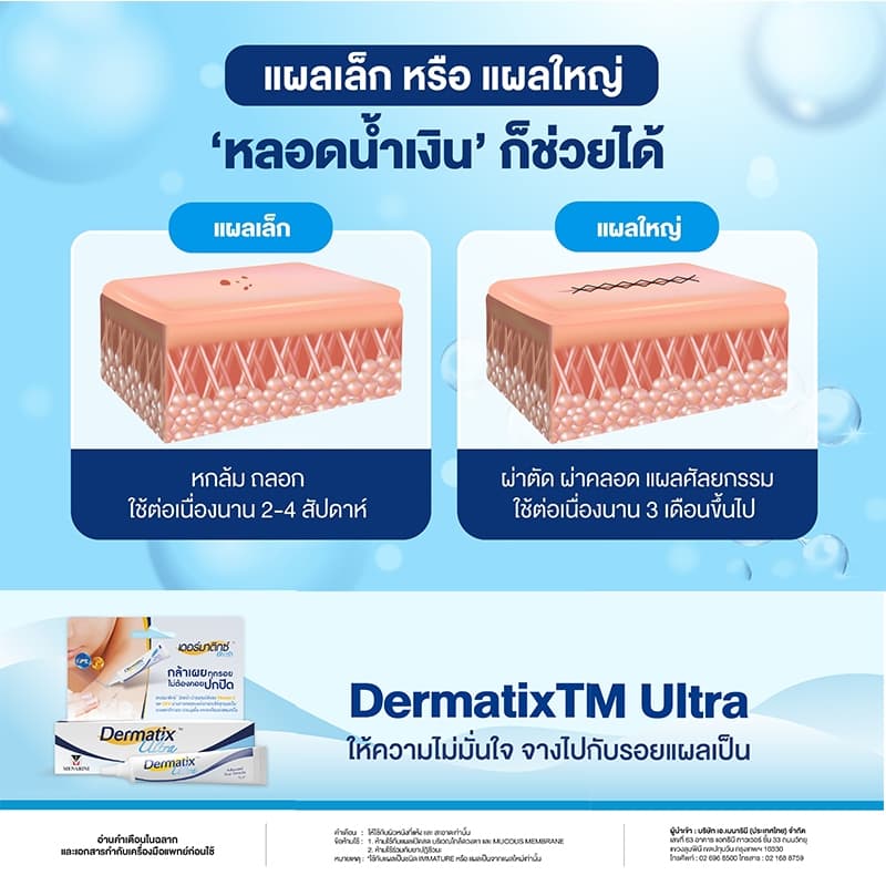 DERMATIX ULTRA GEL 15G. เจลป้องกันรอยแผลเป็น รูปที่ 9