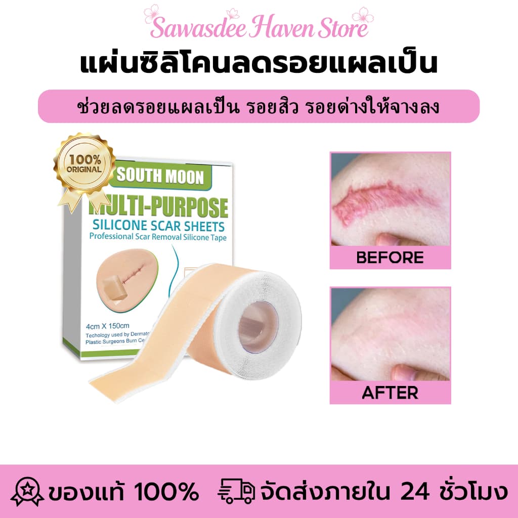 South Moon silicone scar sheet รักษารอยแผลเป็น แผ่นแปะแผลเป็น กําจัดรอยแผลเป็นจากแผลเป็น เผยผิวเนียนสวย รูปที่ 1