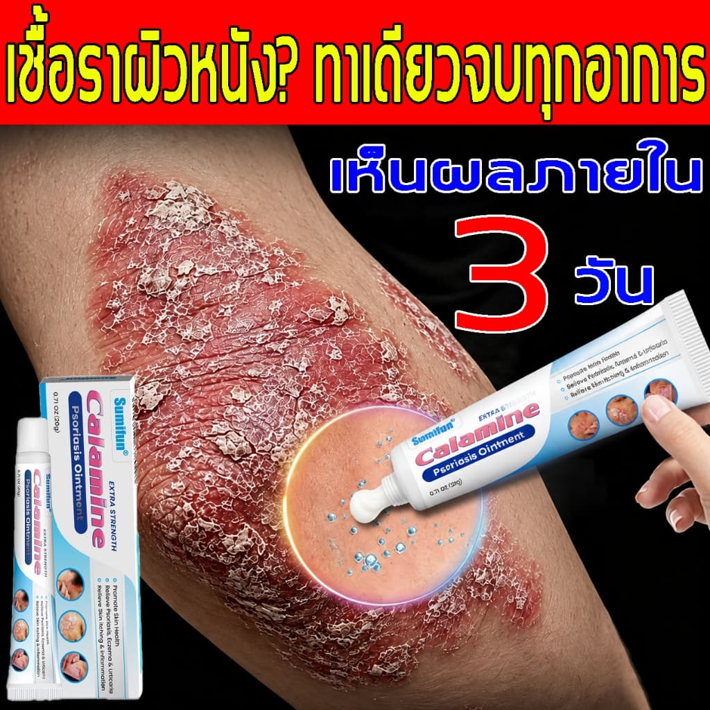 ครีมบำรุงผิว สำหรับผิวคัน ระคายเคือง ผื่น แพ้ ผิวอักเสบ กลาก ผิวบอบบาง อ่อนโยน ส่วนผสมจากธรรมชาติ บำรุงและปกป้องผิว รูปที่ 1