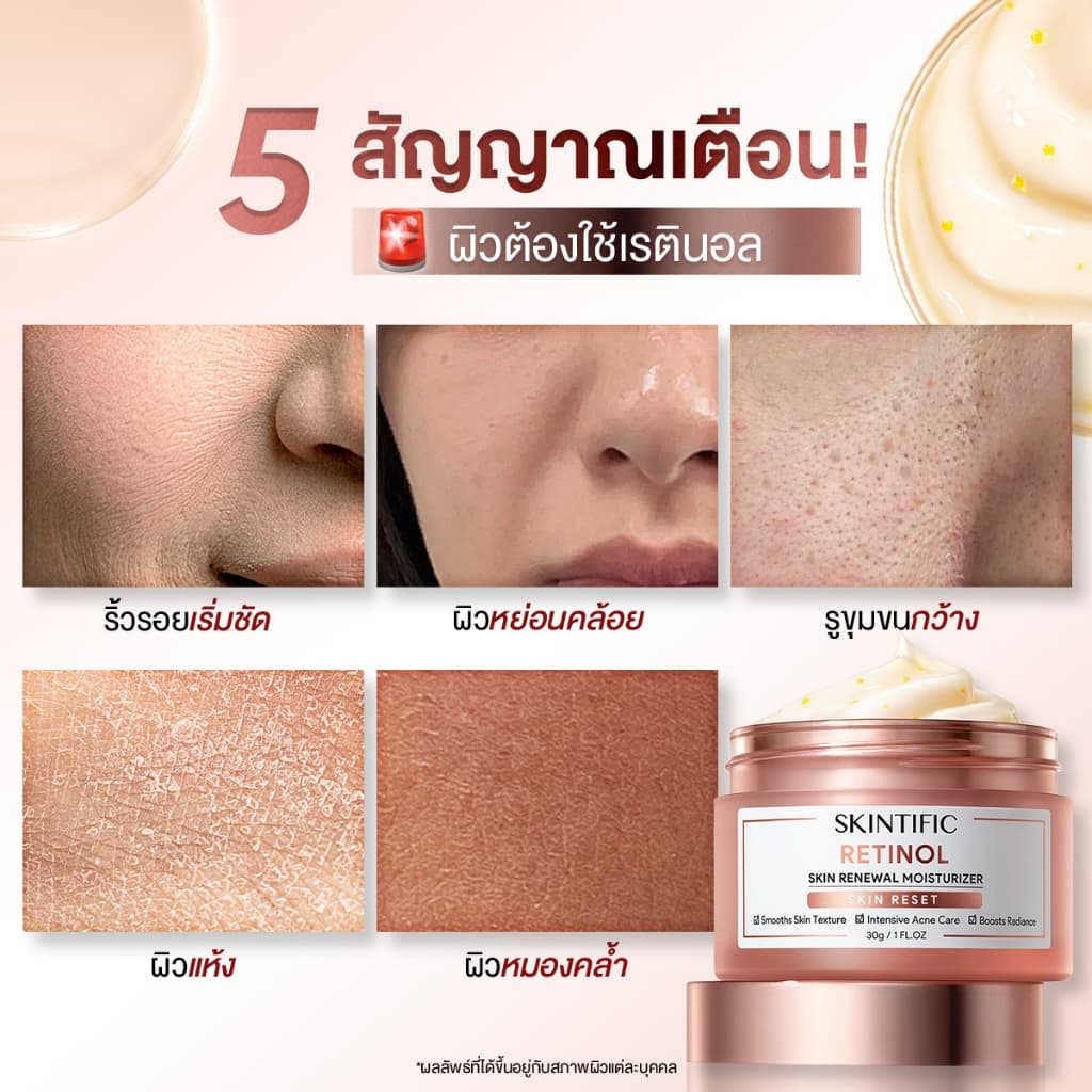 SKINTIFIC Retinol Skin Renewal Moisturizer เรตินอล สคิน รีนิวเวิล มอยเจอร์ไรเซอร์ ครีม ลดเลือนริ้วรอยใน 2 สัปดาห์ รูปที่ 2
