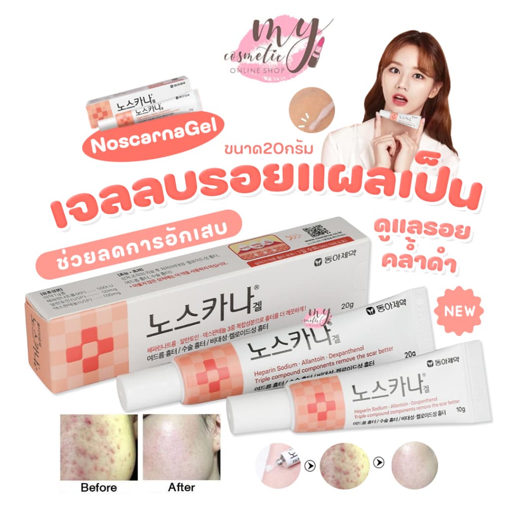 แพ็คเก็จใหม่ Noscana Gel 20g เจลลดรอยแผลเป็น รอยสิว รอยดำ ครีมลบรอยแผลเป็น รูปที่ 1