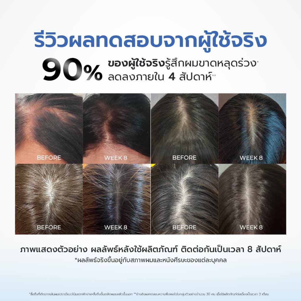 KEBOU 8X DEFENSE HAIR SCALP SERUM เวชสำอางลดผมขาดหลุดร่วง ลดรังแคและอาการคันในขั้นตอนเดียว รูปที่ 8