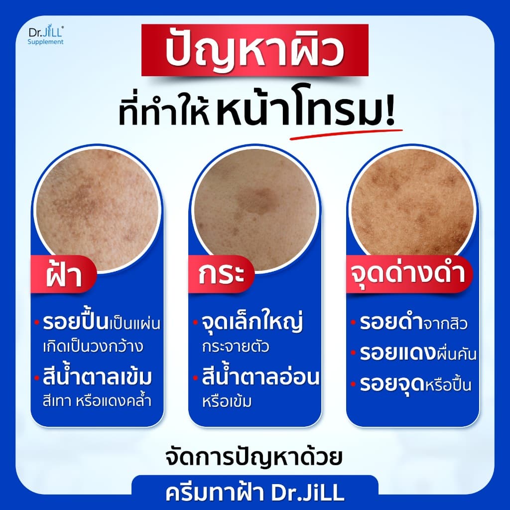 แถมสบู่ 2 ก้อน ครีมทาฝ้า Dr.JiLL Advanced Melasma 3 หลอด 15ml. รูปที่ 3