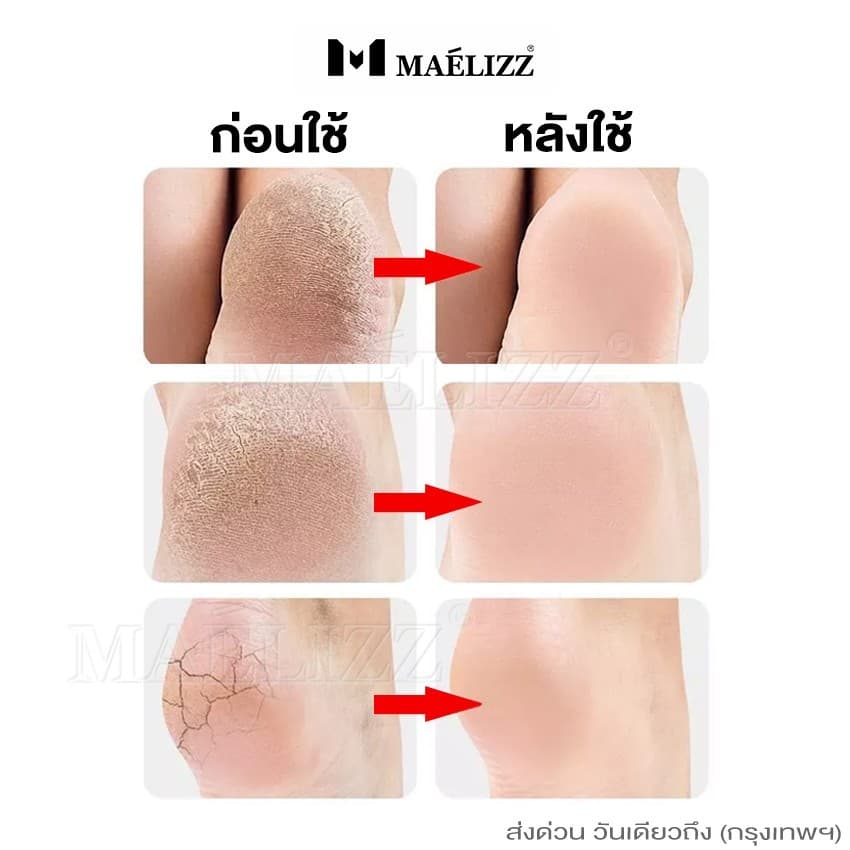 maelizz ซิลิโคนถนอมส้นเท้า รองส้นเท้ากันช้ำ ลดอาการบาดเจ็บ 2ชิ้น รองช้ำ #112 รูปที่ 4