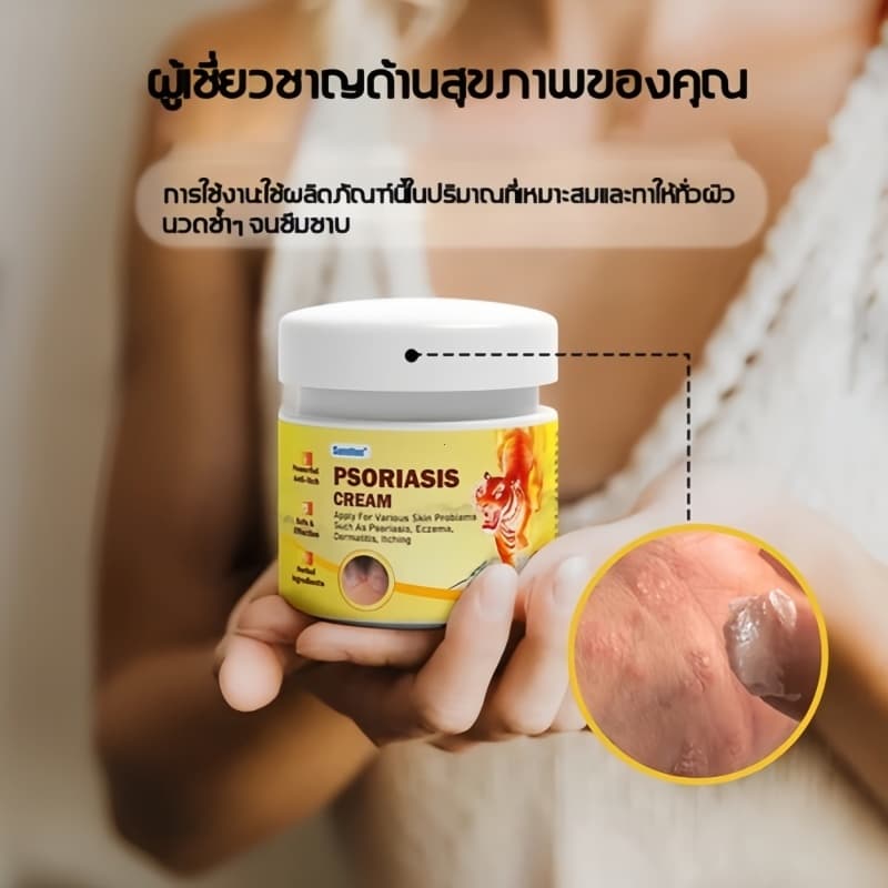 ครีมทาสังคัง สะเก็ดเงินครีม ครีมบำรุงผิว รอยแดง โรคผิวหนัง เกลื้อน กลาก คัน สมุนไพร แก้คันเรื้อรัง คันในร่มผ้า คันในร่มผ รูปที่ 5