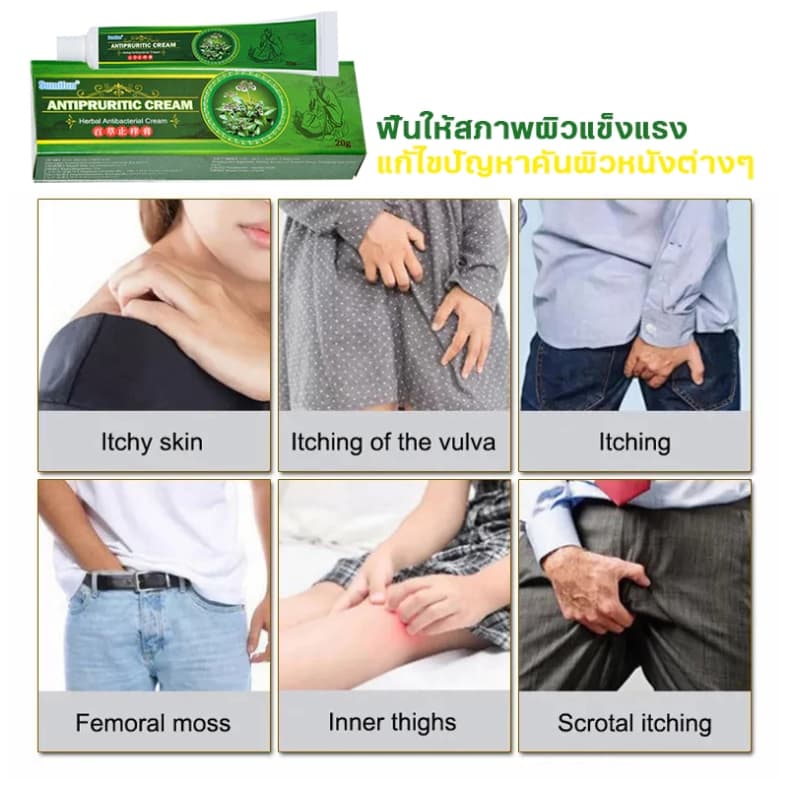 ครีมแก้คันผิว ลดผื่นคัน บรรเทาอาการคัน ฆ่าเชื้อรา ฟื้นฟูผิว เห็นผลไว 20G รูปที่ 6