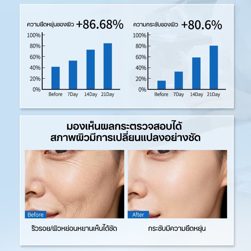 แผ่นแปะร่องแก้มลึก สติกเกอร์ยกกระชับริมฝีปาก เทปสติกเกอร์ ลดริ้วรอย กับเปปไทด์เข้มข้น ลดริ้วรอยบนใบหน้า ตา รูปที่ 6