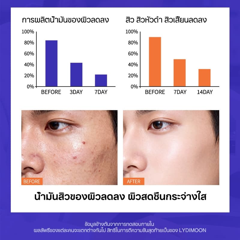 เมน โฟมล้างหน้า เจลล้างหน้าสำหรับผู้ชายโดยเฉพาะ 100g ลดสิว ควบคุมความมัน ทำความสะอาดรูขุมขน ผิวสะอาดสดชื่น รูปที่ 9